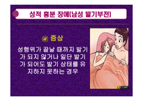 성기능 장애 -14