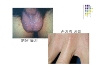 성의 과학 개론-성병에 관하여 -16