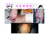 아동학대 -4