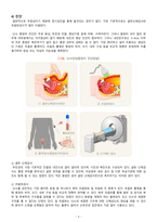 A+ 모성간호학실습 난소종양 Benign ovary tumor 케이스 A+ 문헌고찰 간호진단, 간호과정 2개-5