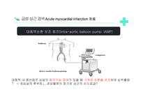 심근경색의 원인 검사 치료-16