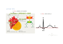 심실에서 발생하는 부정맥-3