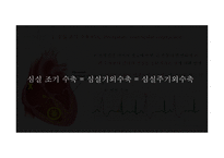 심실에서 발생하는 부정맥-4