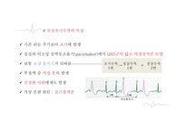 심실에서 발생하는 부정맥-5