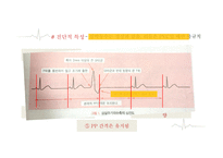 심실에서 발생하는 부정맥-6