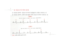 심실에서 발생하는 부정맥-7