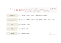 심실에서 발생하는 부정맥-18