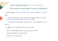 관상동맥 중재술-4
