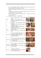 간호학 - 고위험신생아의 특징 및 성숙이상-5