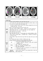 간호학 - 외상성 뇌손상 분류, 진단적 검사-8