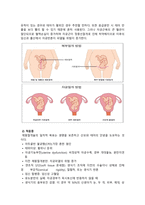 case study 제왕절개-4