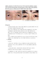 Disease review_JR1_안과_눈꺼풀 처짐(ptosis) & 피부이완증(Dermatochalasis)-3