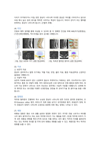 지역사회간호학실습 - 오마하간호과정(척추관협착증) A+-4