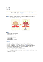 성인간호학 - 요실금간호과정-3