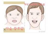 정신지체 정신지체원인 정신지체특성 정신지체치료교육 정신지체현황-17
