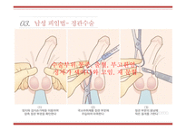 사랑과피임 피임 임신의의미 피임의미 피임의중요성 남성피임법 여성피임법-16