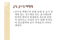 백혈병 급성 골수성 백혈병 급성 림프구성 백혈병 만성 골수성 백혈병 만성 림프구성 백혈병-3