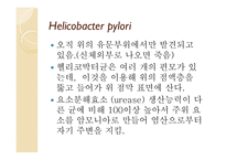 백혈병 급성 골수성 백혈병 급성 림프구성 백혈병 만성 골수성 백혈병 만성 림프구성 백혈병-11