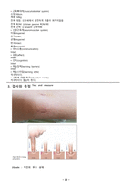 물리치료 SOAP 무릎수술 Lt Collateral ligament Rupture-3