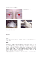 희귀병의 종류와 실태-9