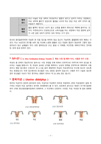 케이스_Missed abortion_개인정보X-9
