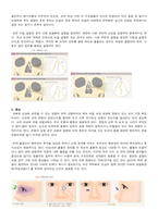 성인간호학실습 케이스스터디 (코뼈골절) [간호진단 및 간호과정 3개]-6