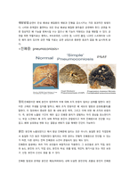 성인간호학실습 케이스스터디 (만성폐쇄성폐질환 COPD) [간호진단 및 간호과정 4개]-10