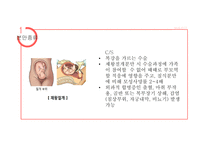산욕기 산모의 신체적변화 및 간호사정 [PPT 발표자료]-4