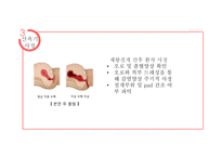 산욕기 산모의 신체적변화 및 간호사정 [PPT 발표자료]-17