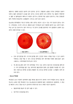 성인간호학 당뇨병 주제학습-16