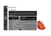 심근경색(STEMI) 간호과정(5개) [PPT 발표자료]-11