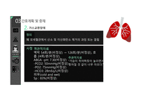 심근경색(STEMI) 간호과정(5개) [PPT 발표자료]-15