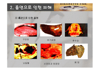 [현대생활과 체육 A+] 흡연에 대한 질병 및 통계를 통한 금연 관리 대책-10