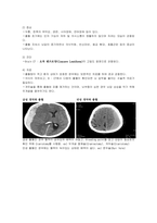 신규간호사도 이해할 수 있게 만든 뇌내출혈 및 두개내압 공부-10