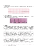 2021년 2학기 응급간호학(다음 심전도가 ① 어떤 리듬인지 판단하고, ② 관련된 내용을 3가지 이상 기술, 심폐소생술 상황 시, 에피네프린 투여 방법, 발작성 심실상성 빈맥의 ① 정의, ② 증상, ③ 치료 방법, 공기로 전파되는 감염성 질환 환자 간호 시, 고려할 사항을 5가지 이상 제시하시오-4
