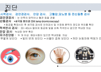 	a++칭찬받은 과제 수술간호 백내장 ppt 프레젠테이션 -안구의 구조와 기능 -정의 -원인 및 병태생리 -위험요인 -분류 -임상증상 -진단과 치료방법 -수술종류 -수술 금기 사항 -수술과정 -백내장 유화술 -인공후방수정체 삽입술 -수술 후 간호 -예방간호 -해외논문 -Q & A -출처-11