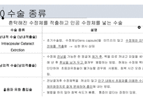 	a++칭찬받은 과제 수술간호 백내장 ppt 프레젠테이션 -안구의 구조와 기능 -정의 -원인 및 병태생리 -위험요인 -분류 -임상증상 -진단과 치료방법 -수술종류 -수술 금기 사항 -수술과정 -백내장 유화술 -인공후방수정체 삽입술 -수술 후 간호 -예방간호 -해외논문 -Q & A -출처-13