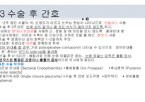	a++칭찬받은 과제 수술간호 백내장 ppt 프레젠테이션 -안구의 구조와 기능 -정의 -원인 및 병태생리 -위험요인 -분류 -임상증상 -진단과 치료방법 -수술종류 -수술 금기 사항 -수술과정 -백내장 유화술 -인공후방수정체 삽입술 -수술 후 간호 -예방간호 -해외논문 -Q & A -출처-18