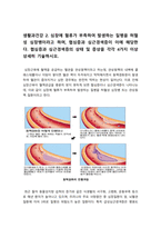 생활과건강 기말 2022] 심혈관계의 해부생리적 특성, 협심증과 심근경색증, 간의 주요 기능을 6가지, 인간관계 갈등 해결에 효과적인 기법 두 가지 -생활과건강, 2022년 방송대 생활과건강 기말 과제물, 생활과건강-4