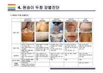 원숭이 두창 감염현황, 감염증세 감염특징, 유행사례 및 대유행 가능성 [원숭이두창,원숭이 두창,Monkey Pox,Pox]-14