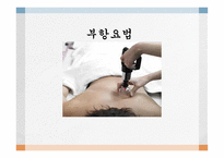 부항요법-1