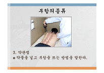 부항요법-17