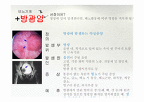 병리학 과제 1(비뇨기계, 생식기계, 내분비기계)-3