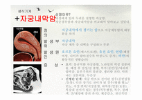 병리학 과제 1(비뇨기계, 생식기계, 내분비기계)-10