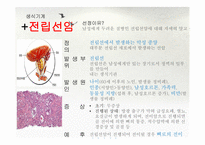 병리학 과제 1(비뇨기계, 생식기계, 내분비기계)-12