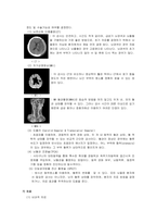 [성인내과케이스] 뇌경색 (cerebral infarction stroke) 케이스 및 간호과정-6
