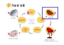 여성실습 난소낭종 케이스 (PPT 자료)-6