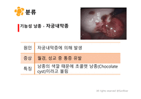 여성실습 난소낭종 케이스 (PPT 자료)-10