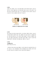 편도선염 문헌고찰-5