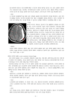 A+ 성인간호실습 Traumatic Brain Injury  T-SDH 케이스-6